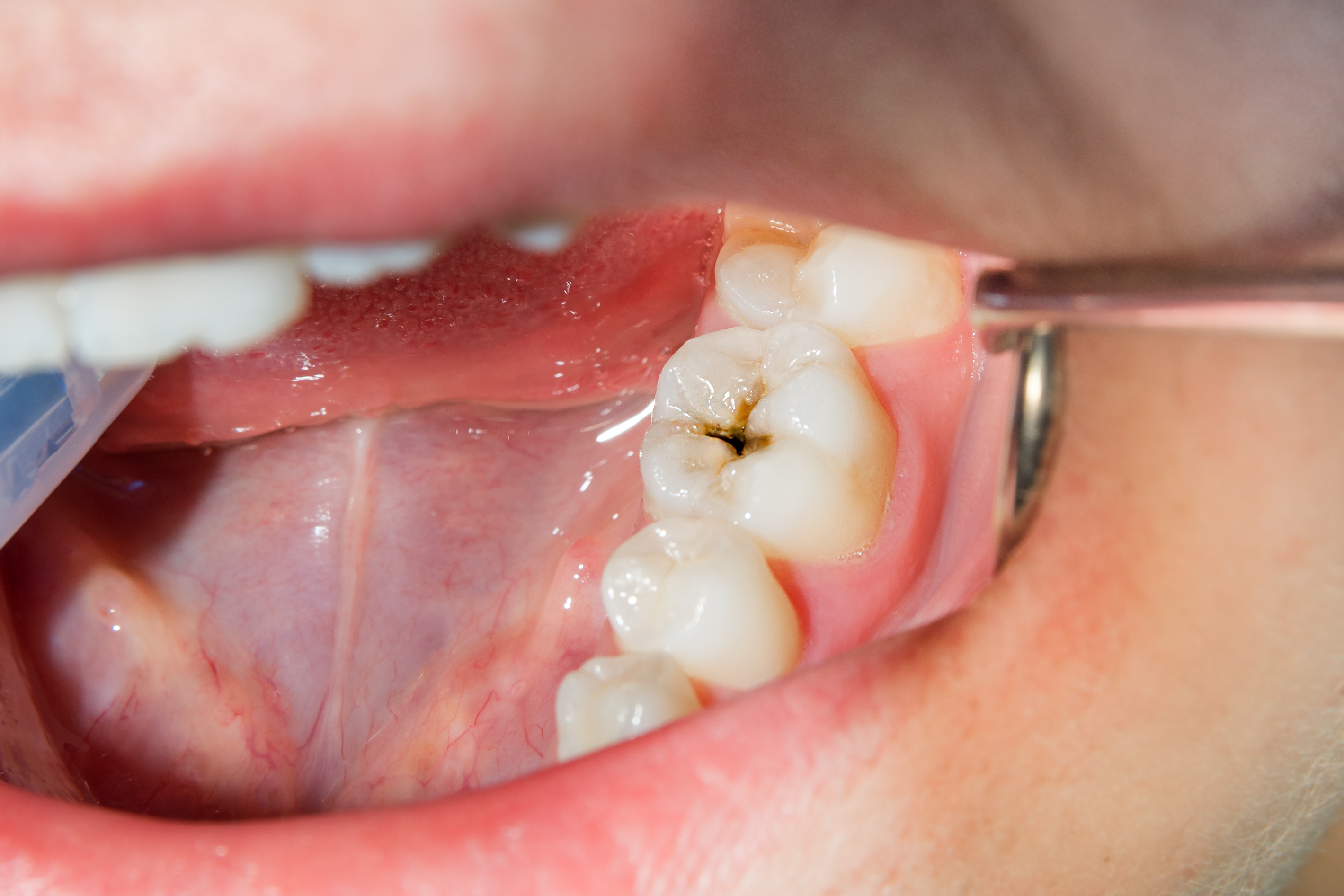 Odontología conservadora
