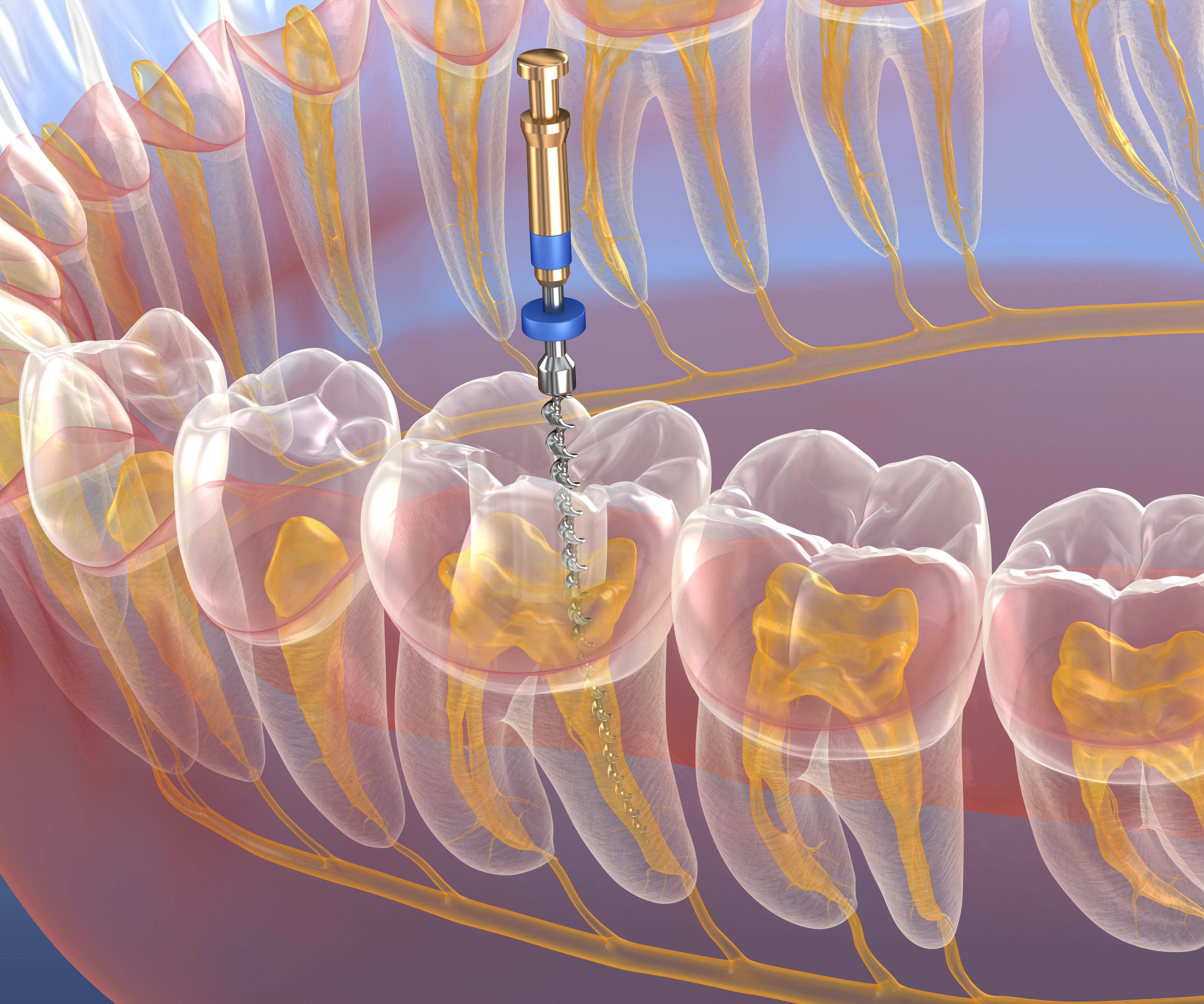 Endodoncia