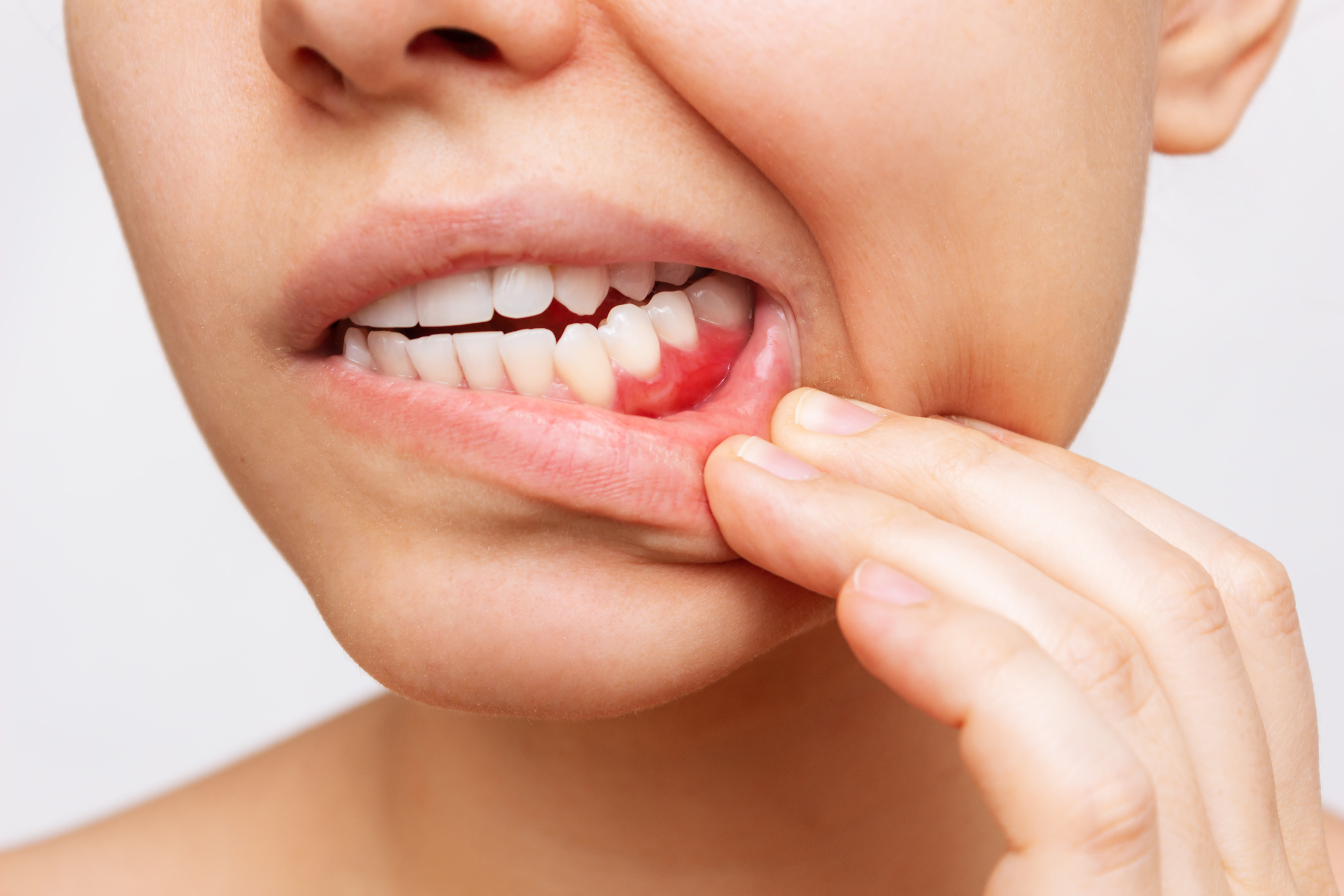 Periodoncia